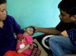 Avifa Humayra (2 tahun), balita asal Pare-Pare, Sulawesi Selatan dinyatakan alami kelainan otak oleh dokter Ratna Hafid dari RSUD Andi Makkasau Pare-pare. Sebelumnya balita ini diduga menderita gizi buruk karena bobot badannya yang hanya 6 kilogram meski usianya sudah 2 tahun.